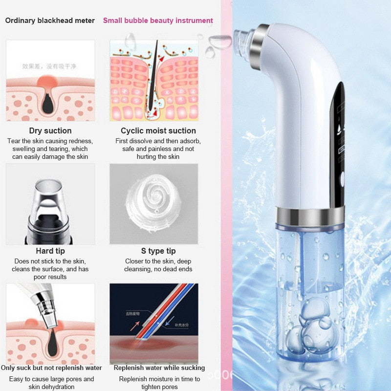 Electric OXY Blackhead Remover - Vintage tees for Women