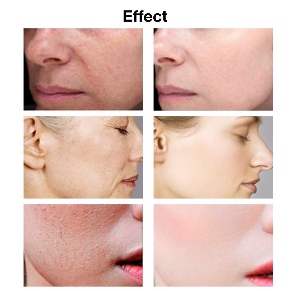 Hyaluronic Acid Face Serum Anti-Aging Shrink Pore Whitening Moisturizing Essence Face Cream - Vintage tees for Women