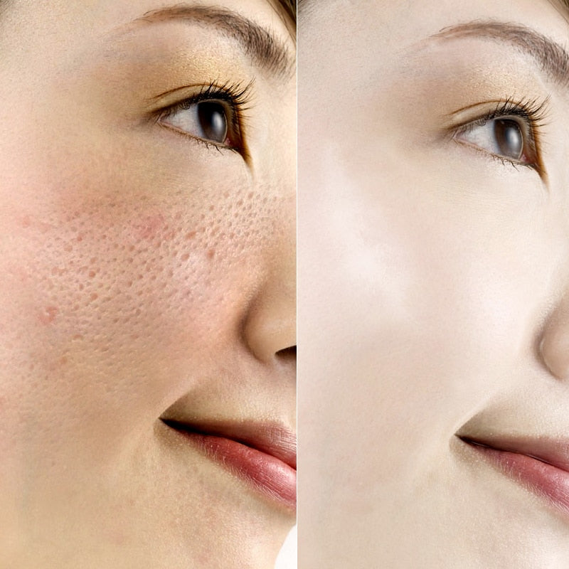 Hyaluronic Acid Face Serum Anti-Aging Shrink Pore Whitening Moisturizing Essence Face Cream - Vintage tees for Women