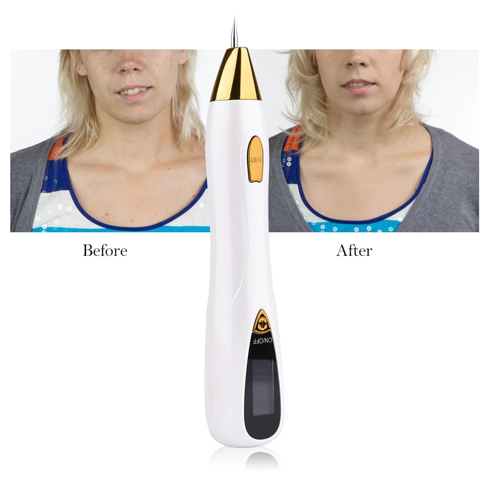 Skin Care Laser Mole Tattoo Freckle Removal Pen LCD Sweep Spot Mole Removing Wart Corns Dark Spot Remover - Vintage tees for Women